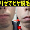 「メンズリゼ」のヒゲ脱毛でヤグレーザーを経験