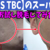 【MEN'S TBC】のスーパー脱毛